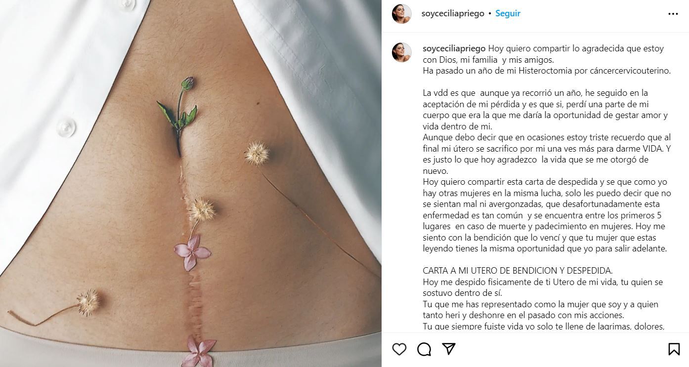 Cecilia Priego condemned not being able to become a mother, but was grateful for the second chance at life that the operation had given her (Photo: Instagram)