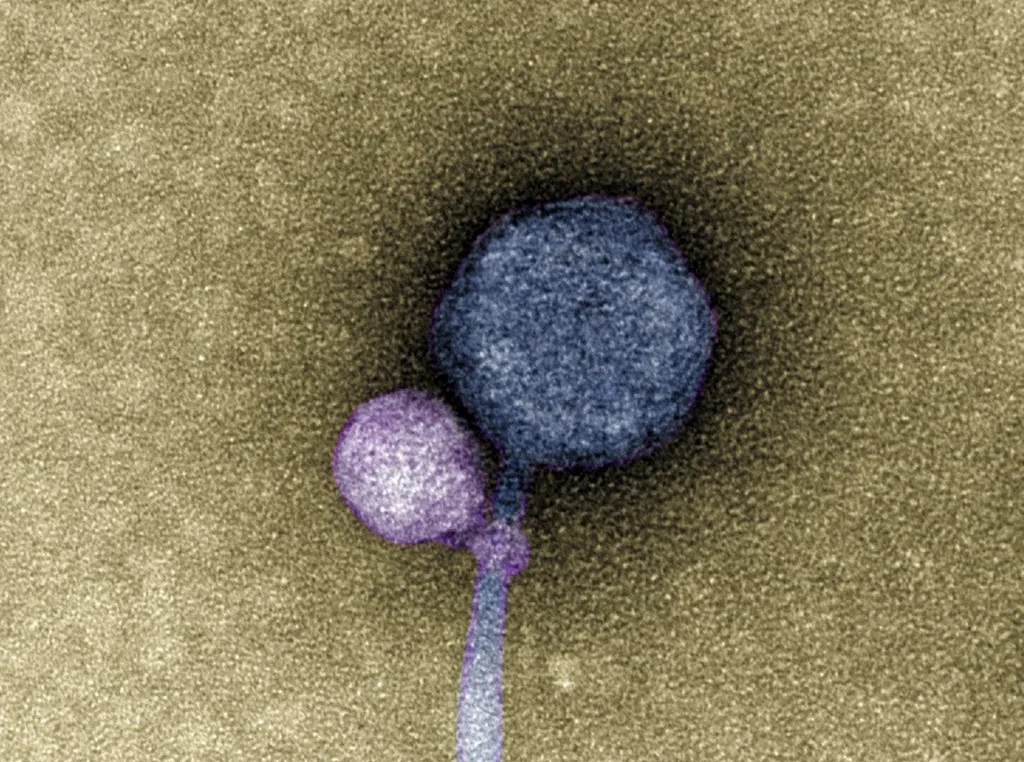 Satellite bacteriophage (left) attached to the larger helper bacteriophage (right).  Photo credit: Tagide deCarvalho/UMBC.